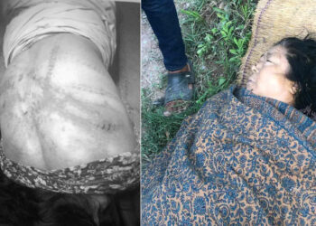 рддреЗрдорд╛рд▓рдорд╛ рд░рдб рдкреНрд░рд╣рд╛рд░ рдЧрд░реА релрео рд╡рд░реНрд╖реАрдп рдорд╣рд┐рд▓рд╛рдХреЛ рд╡рд┐рднрддреНрд╕рд╛ рд╣рддреНрдпрд╛