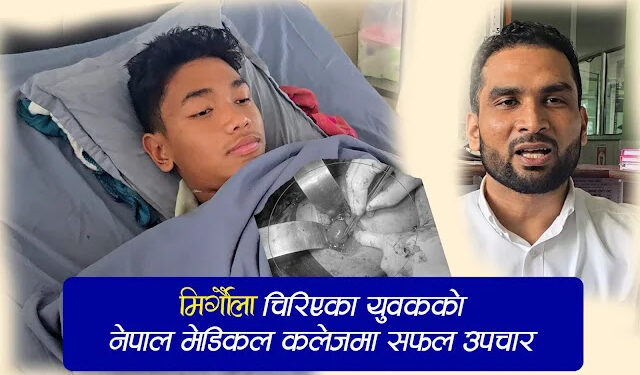 मिर्गौला चिरिएका युवकको नेपाल मेडिकल कलेजमा सफल शल्यक्रिया
