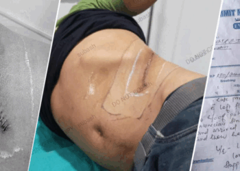 सिन्धुलीका युवकको मिर्गौला निकालिएको घटनामा नुवाकोटका समिर पक्राउ